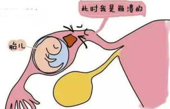 同被传代孕_代孕的成功率_北京试管婴儿医院做试管要剖腹产吗