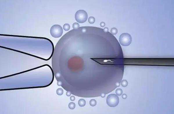 代孕需要自己的卵子吗_代孕中心包生男孩_试管婴儿丨女方体检项目及前期准备